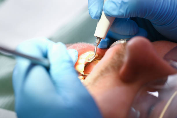 Best Emergency Dental Care for Broken or Chipped Teeth in Wadena, MN