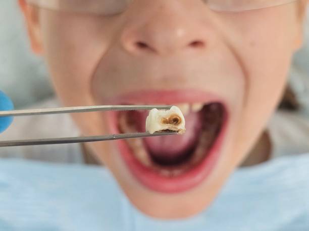 Best Cosmetic Emergency Dentistry in Wadena, MN